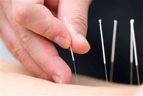 Acupuncture'sImpactonCellularFunction