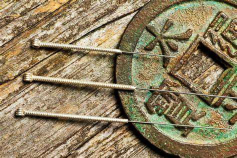 Acupuncture:ANeedle'sPathtoSerenity