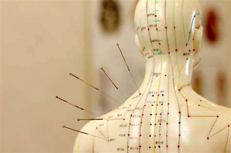 Acupuncture:De-StressingtheBodyThroughEnergyFlow