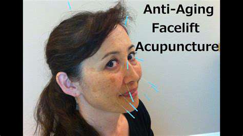 TheFutureofTCMAcupunctureinAnti-Aging