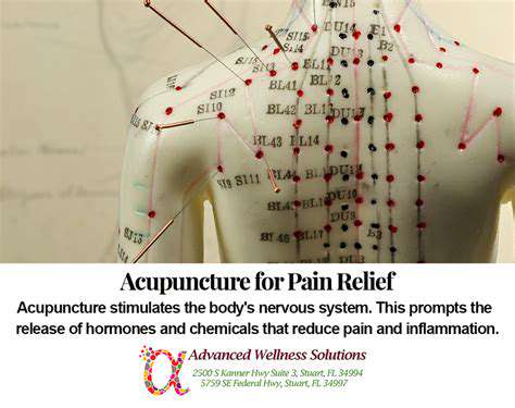 PotentialBenefitsofAcupunctureforBackPainRelief