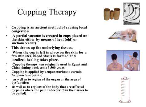 TheScienceBehindtheSuction:HowCuppingWorks